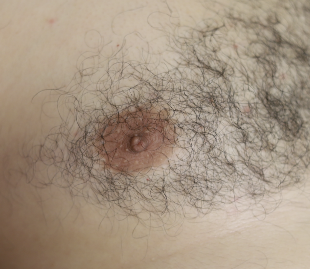 Male nipple